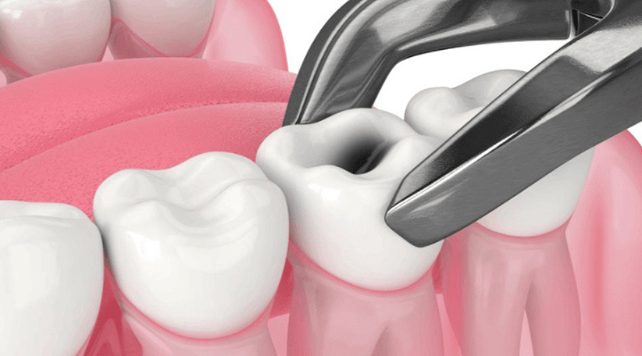 Happy person with braces